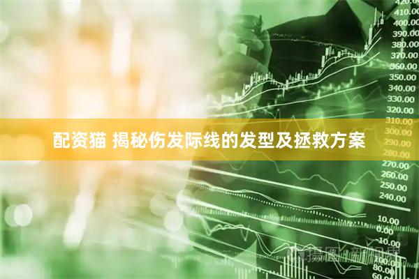 配资猫 揭秘伤发际线的发型及拯救方案